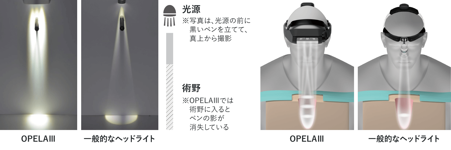 Opela 3 Light Features