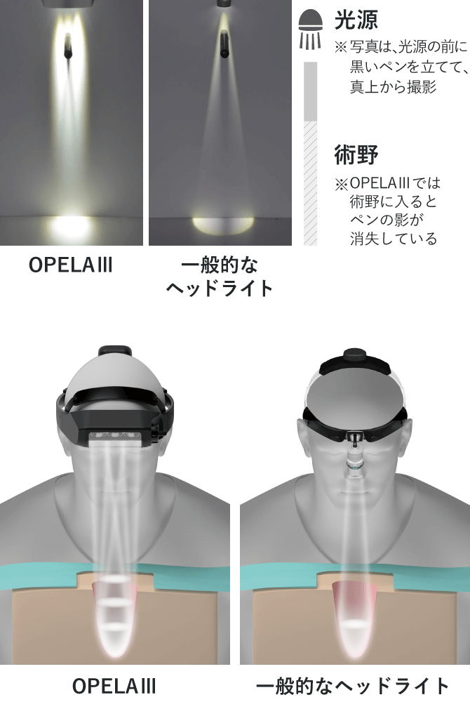 Opela 3 Light Features